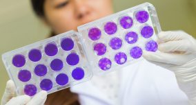 Dengue Fever 5-Paragraph Essay: How to Write [2025 Update]